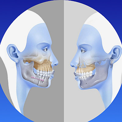 image/png