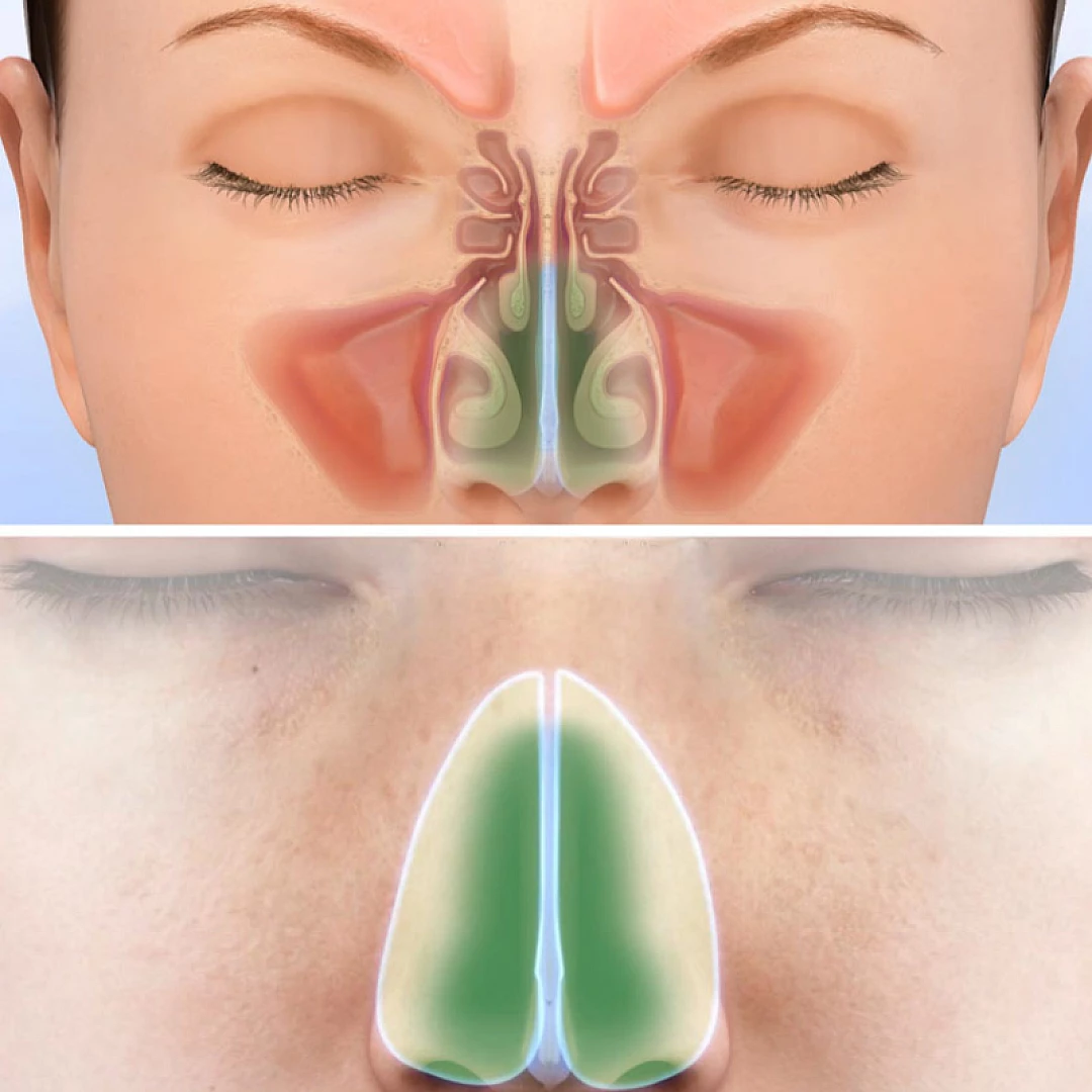 image/png