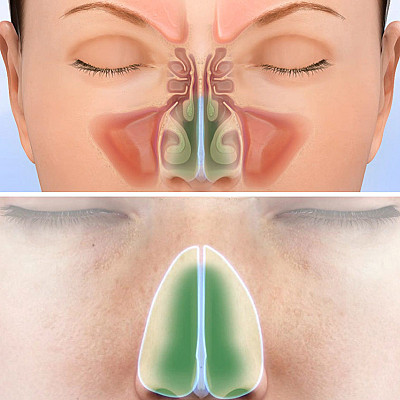 image/png