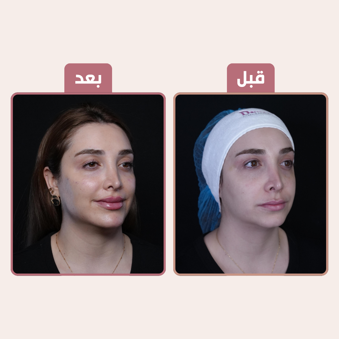 image/png